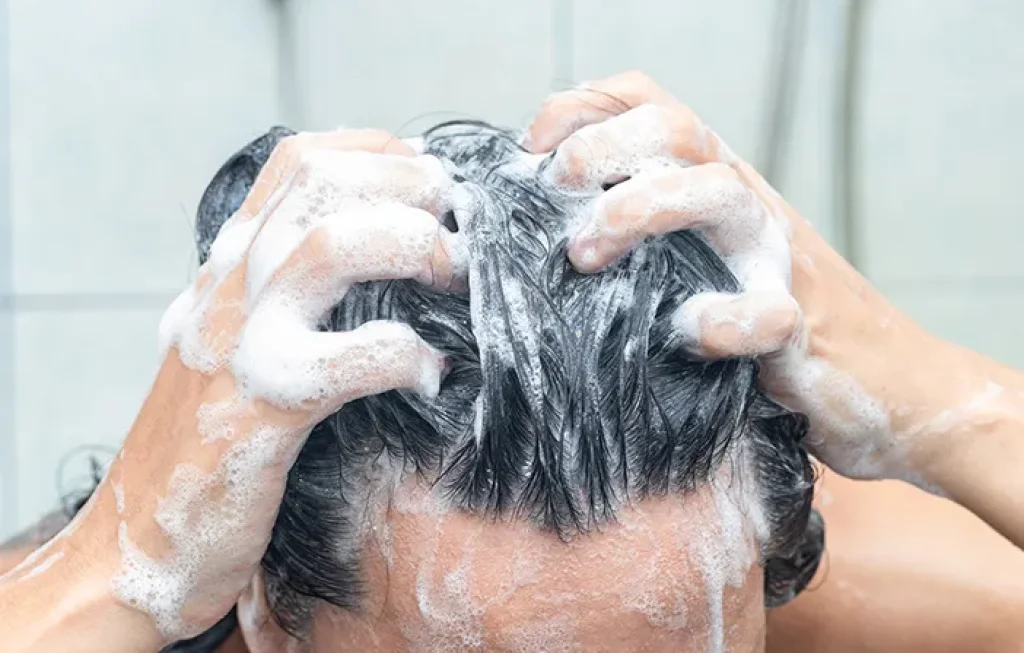 cara membasmi kutu rambut