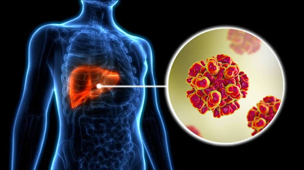 Cegah Penularan Hepatitis