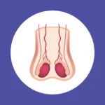 Testosteron Rendah