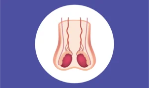 Testosteron Rendah Testosteron Rendah