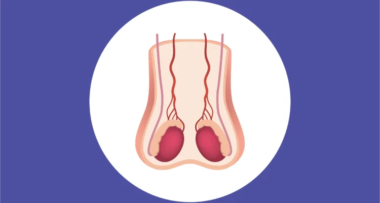 Testosteron Rendah
